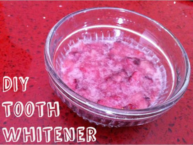 tooth whitener