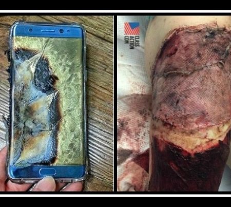 Έκρηξη από Samsung προκάλεσε σοβαρούς τραυματισμούς!