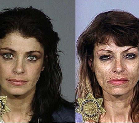 14 Εικόνες πριν και μετά την χρήση ναρκωτικών!
