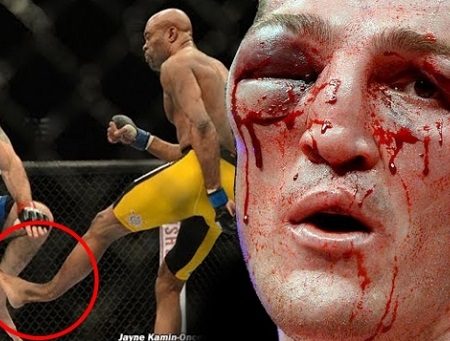 Οι χειρότεροι τραυματισμοί στην ιστορία του MMA!