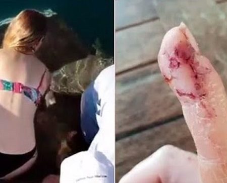 34χρονη τάιζε καρχαρίες όταν της έκοψαν το δάχτυλο on camera!